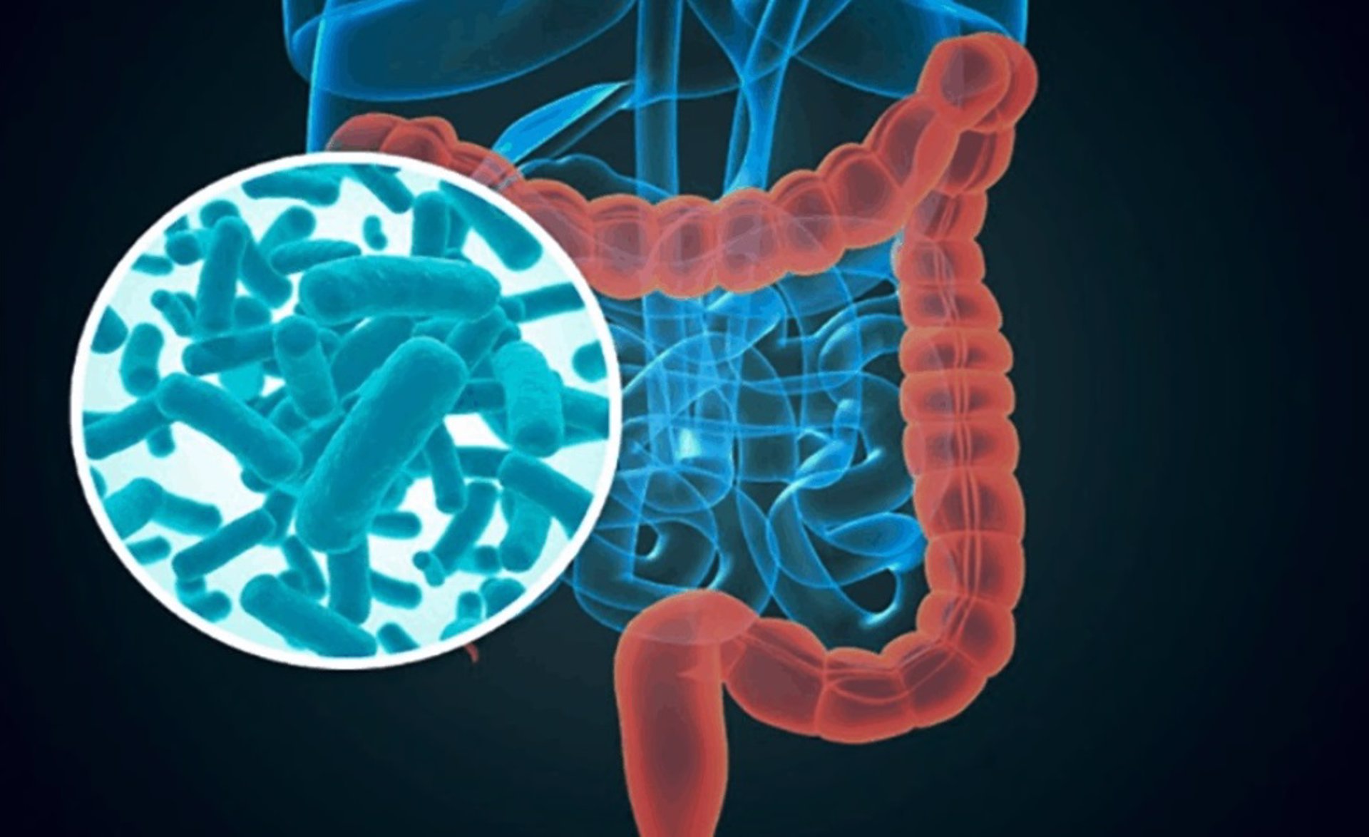 Una microbiota intestinal desequilibrada podría afectar al estado de